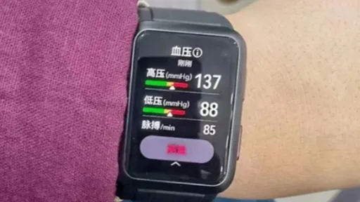 Huawei Watch D aparece em imagens reais com medidor de pressão sanguínea
