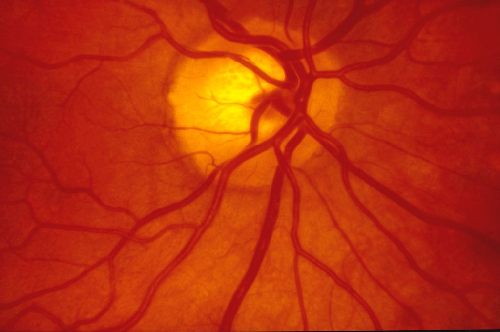 Coronavírus SARS-CoV-2 pode chegar até a retina humana (Imagem: Reprodução/Twenty20photos/Envato Elements)