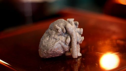 Mais sucesso: tecnologia imprime modelo de coração de crianças antes da cirurgia