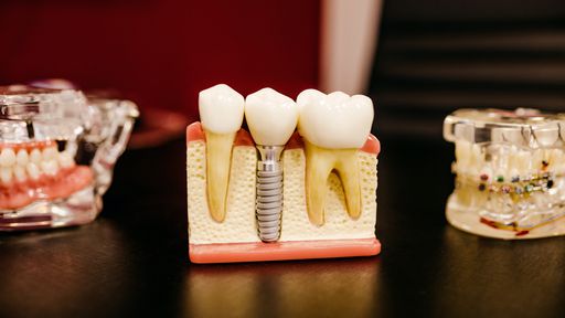 Recuperados da COVID-19 estão relatando perda de dentes saudáveis