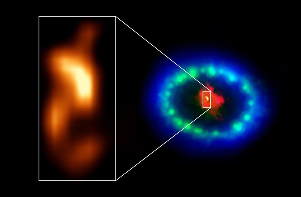 Detalhe que mostra a "bolha" no núcleo da supernova 1987A (Imagem: reprodução/Phys.org)