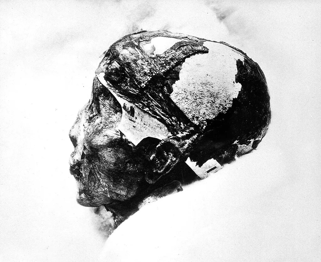 Cabeça mumificada de Tutancâmon, fotografada em 1926 (Imagem: Daily Mirror/CC-BY-4.0)