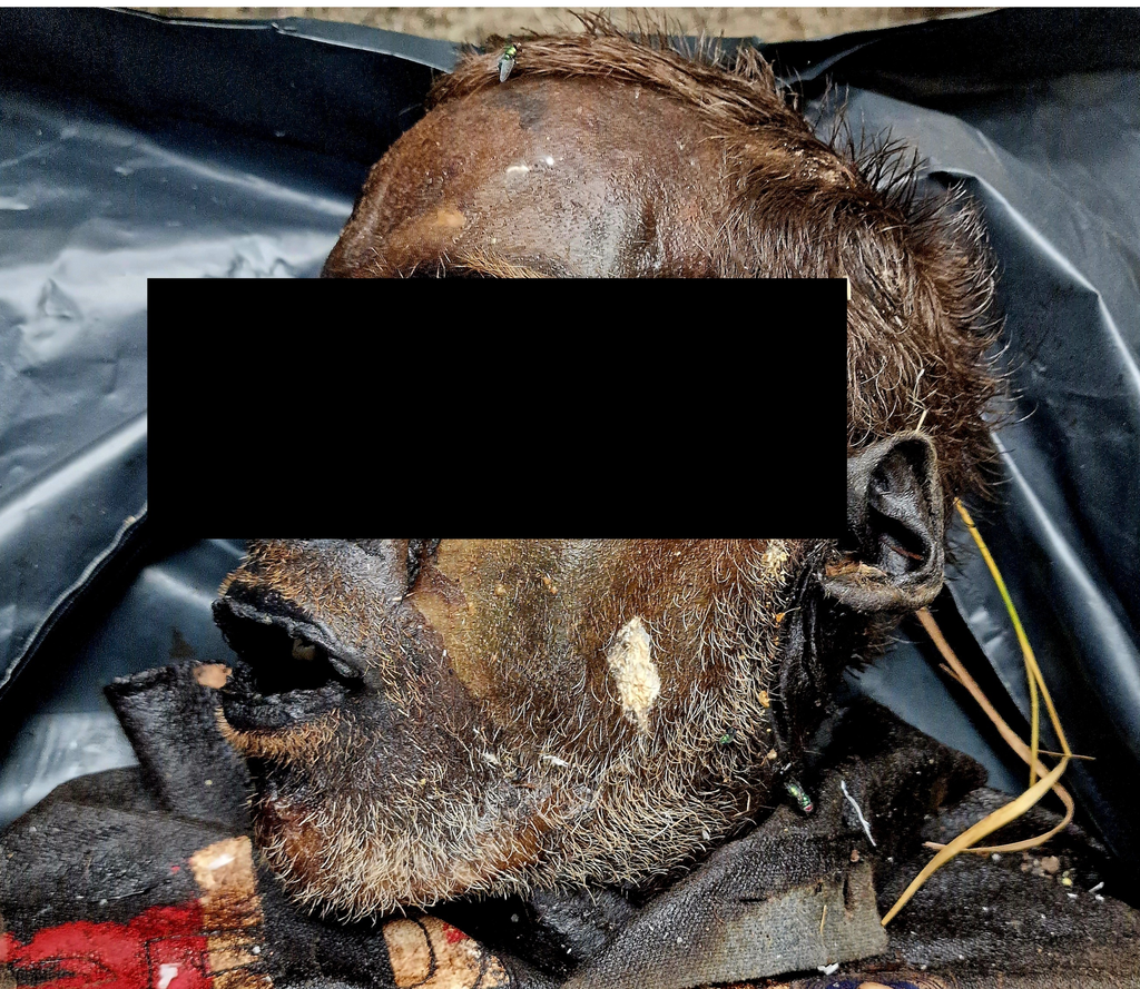 Cabeça preservada do búlgaro de 34 anos, cuja rápida mumificação é um grande mistério para os especialistas (Imagem: Mileva B, Tsranchev I, Georgieva M, et al./Cureus)