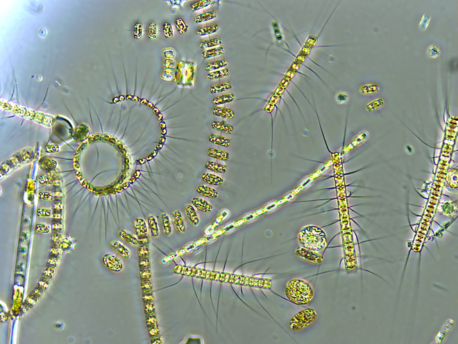 O fitoplâncton normalmente mantém o carbono emitido pelos procariontes em cheque, mas esse balanço está em risco com o aquecimento global (Imagem: University of Rhode Island/Wikimedia Commons)