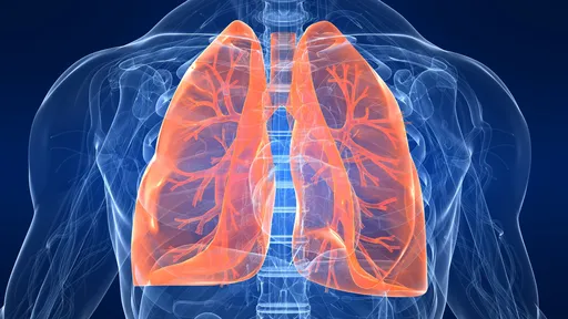 Veja como fica o pulmão de um paciente com sintomas graves de COVID-19