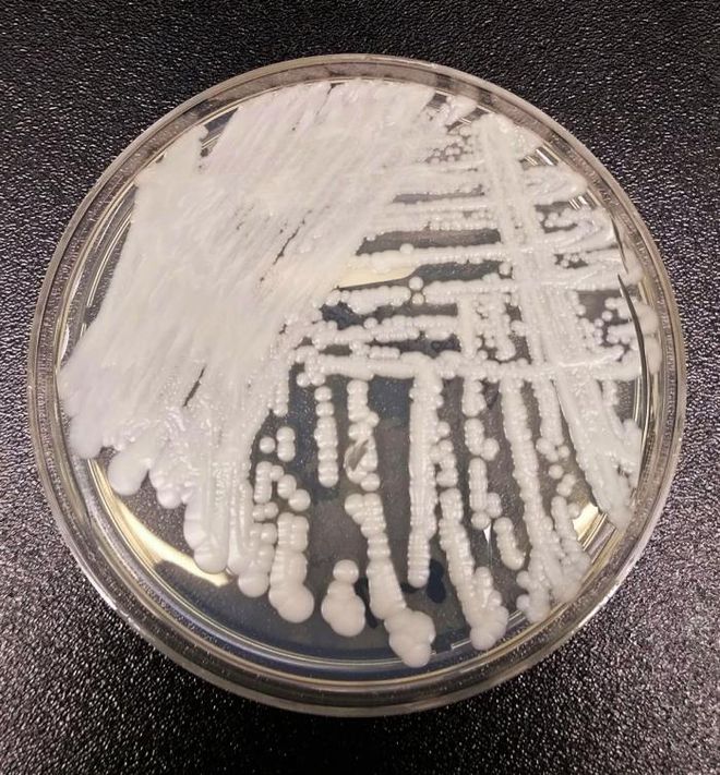 Nanopartículas do Butantan combatem fungos que colocam em risco à saúde humana (Imagemn: Shawn Lockhart/CDC)