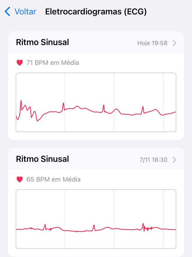 Todos os resultados de ECG do Apple Watch ficam armazenados no app Saúde do iPhone, onde podem ser comparados e compartilhados (Imagem: Lucas Wetten/Canaltech)