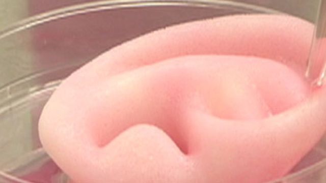 Cientistas criam cartilagem artificial usando impressora 3D