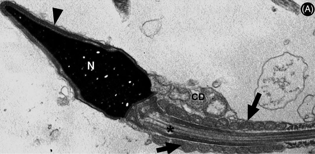 Espermatozoide infectado por covid-19, como mostrado em imagem de microscopia eletrônica (Imagem: Hallak et al./Andrology)