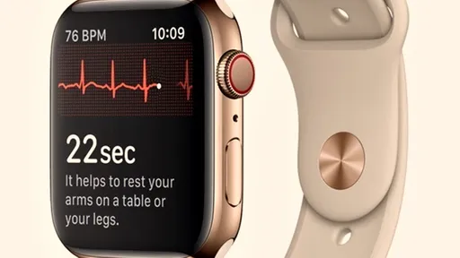 Apple Watch detecta doença melhor que eletrocardiograma de centro médico alemão