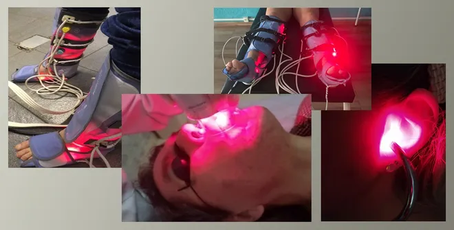 Fotobiomodulação: terapia usa luz para tratar covid longa (Imagem: Reprodução/CEPOF/Agência Fapesp)