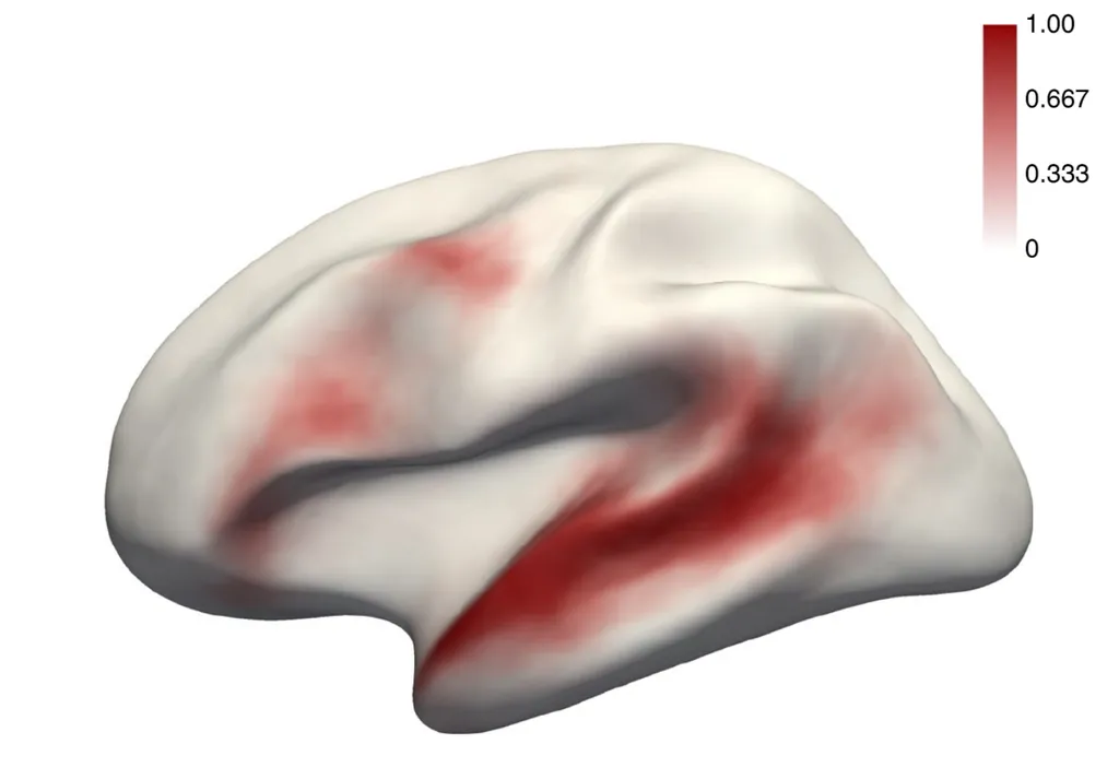 Mapa probabilístico do cérebro: áreas vermelhas são as que mais acendem ao ouvir a língua nativa, e as mais claras, quando ouvimos uma língua desconhecida (Imagem: Malik-Moraleda et al./Nature Neuroscience)