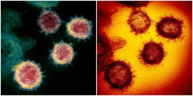 Todos falam, mas poucos viram: confira imagens reais do coronavírus em ação