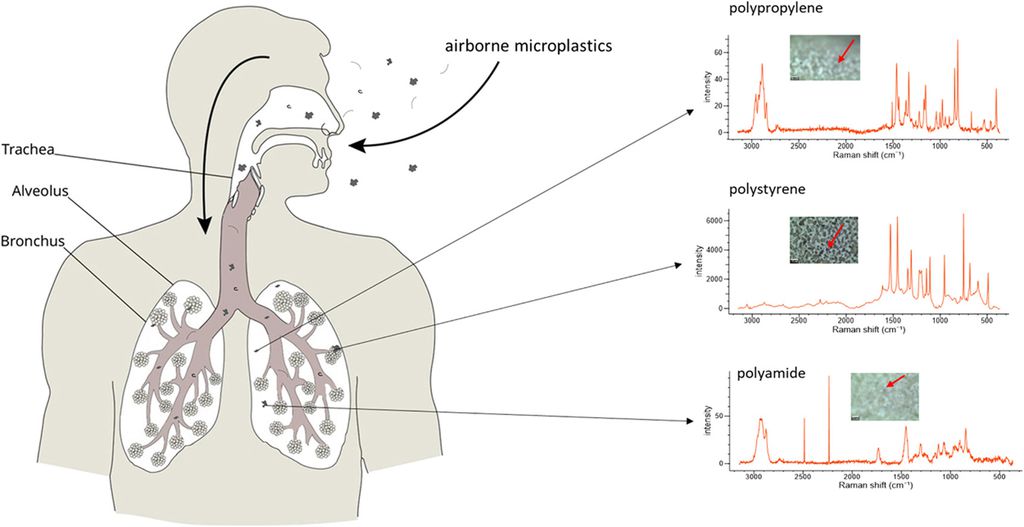 Pesquisa nacional encontra microplásticos no pulmão humano (Imagem: Reprodução/Lourenço et al., 2021/Journal of Hazardous Materials)