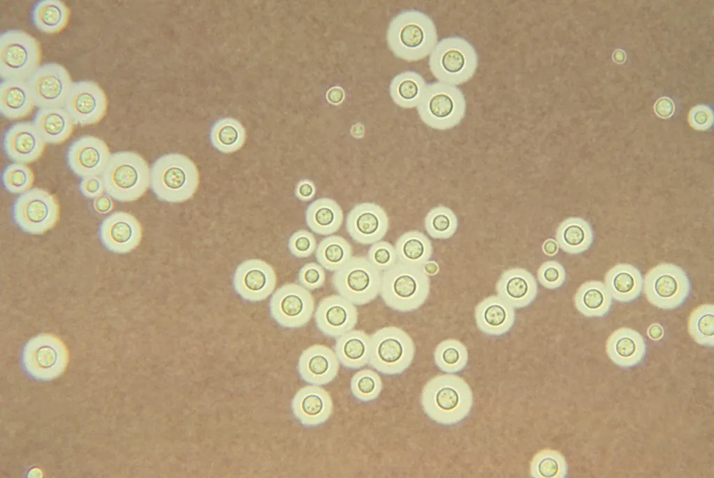 Fotomicrografia do Cryptococcus neoformans, fungo estudado pelos cientistas que modifica seu DNA mediante exposição ao calor (Imagem: U.S. Centers for Disease Control (CDC))