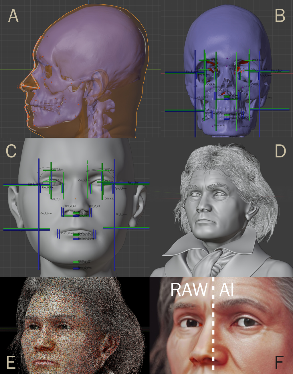 Para a reconstrução facial de Beethoven, Moraes usou fotografias, tomografias e uma máscara facial do artista; roupas e cabelos vieram de fotos da época (Imagem: OrtogOnlineMag/CC-BY-4.0)