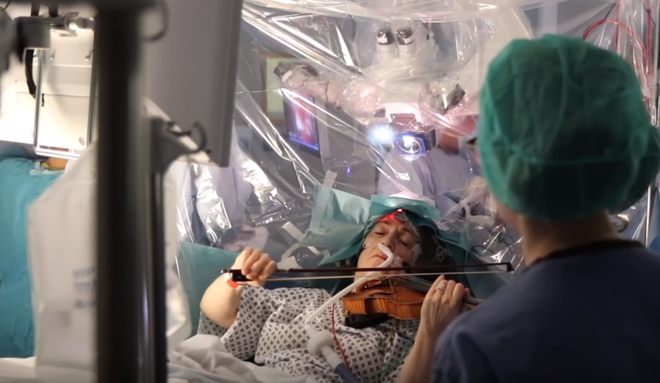 Mulher toca violino durante cirurgia cerebral, sem sentir dor (Foto: Reprodução/ Canal do Youtube do The Guardian)