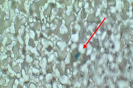 Em autópsia, cientistas encontram microplástico no pulmão (Imagem: Reprodução/FM-USP/Agência Fapesp)