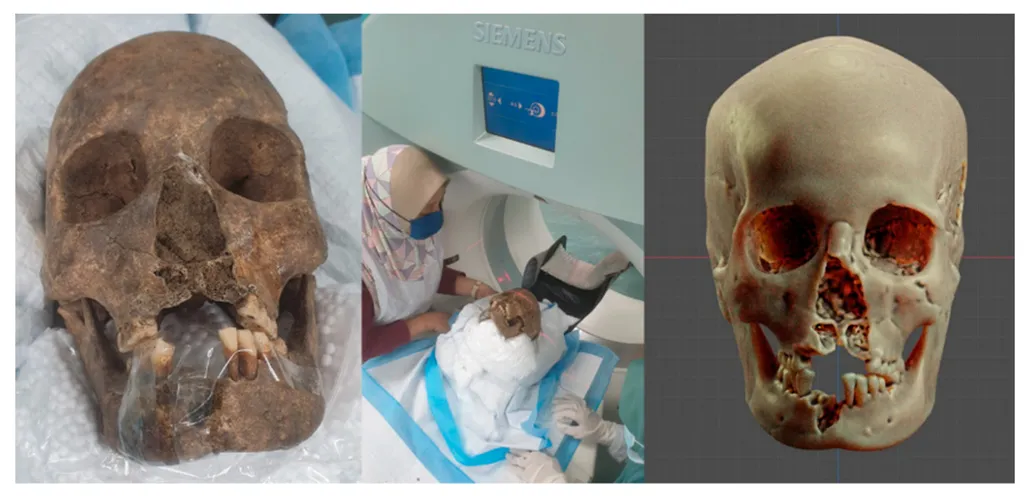Tomografia computadorizada realizada no crânio da mulher malásia da Idade da Pedra (Imagem: Moraes et al./Applied Sciences)