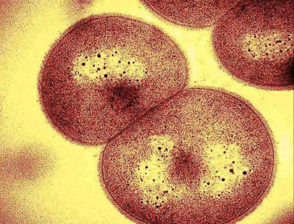 Os incríveis poderes de sobrevivência à radiação que a bactéria possui vem de sua capacidade de fabricar antioxidantes poderosos (Imagem: Defense Visual Information Distribution Service)