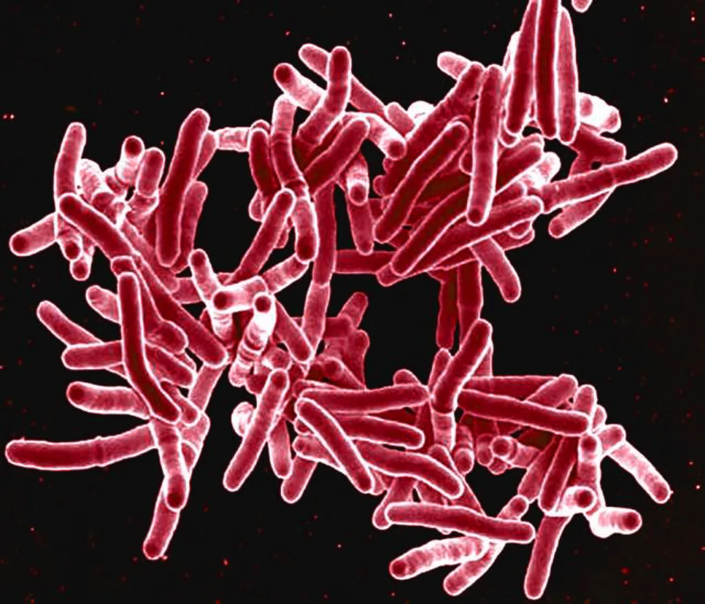 Descoberta da bactéria que causa a tuberculose completa 140 anos (Imagem: Reprodução/NIAID/CDC)