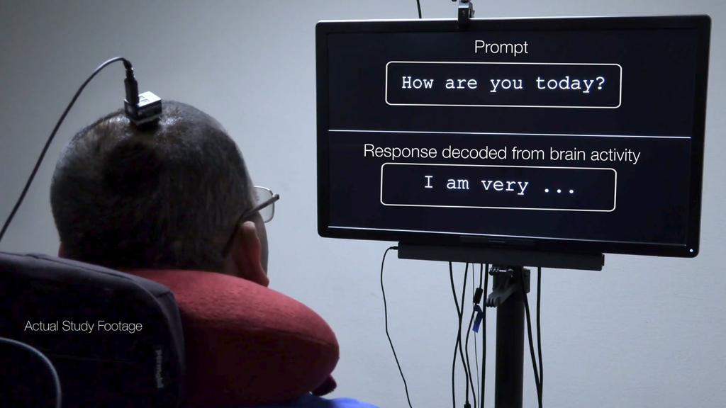Interface cérebro-máquina devolve capacidade de formar frases a homem com paralisia severa (Imagem: University of California San Francisco)