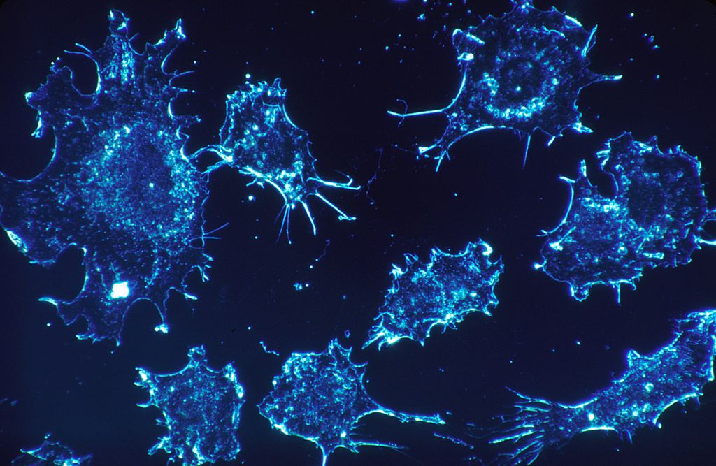 Vírus modificado consegue fazer tumores atacarem a si mesmos