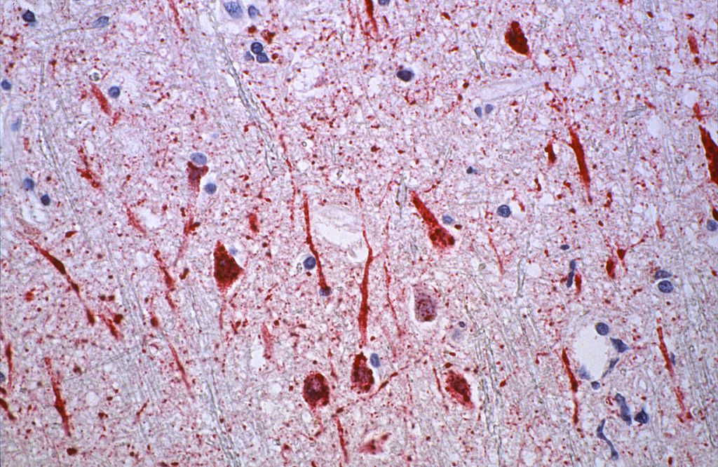 O vírus Nipah, mostrado na foto microscópica, é uma das doenças preocupantes aos cientistas, que acreditam que as zoonoses virais causarão até 12 vezes mais mortes até 2050 (Imagem: CDC/ Brian W.J. Mahy)