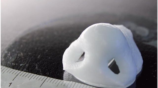 Impressora 3D cria implantes de nariz e orelha