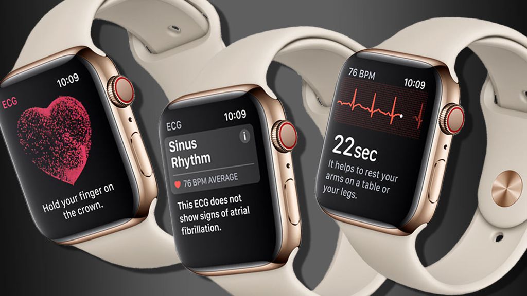 Apple se reúne com Anvisa para regularizar ECG do Watch no Brasil