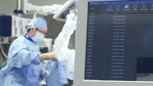 Como uma biópsia guiada por robô pode melhorar o diagnóstico do câncer?