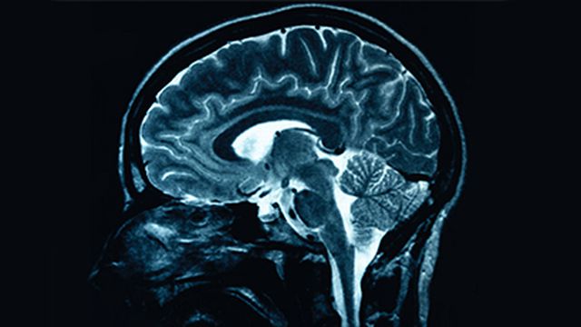 Cientistas recuperam memória de ratos com alzheimer usando ultrassom