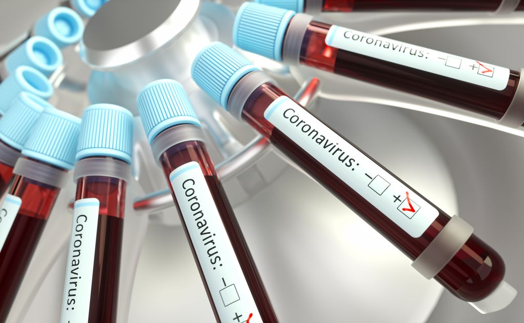 Após vacinação contra a COVID-19, testes de sangue podem indicar e a vacina fez efeito ou não (Imagem: Reprodução/Kts Image/Envato)