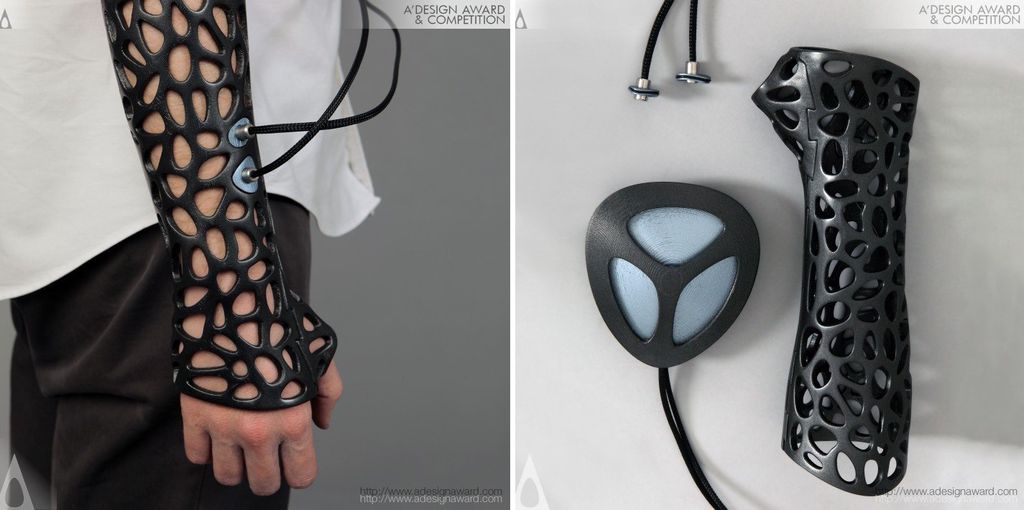 The Osteoid The Osteoid