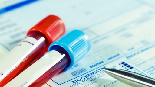 Inteligência artificial pode ser usada para prevenir doenças renais