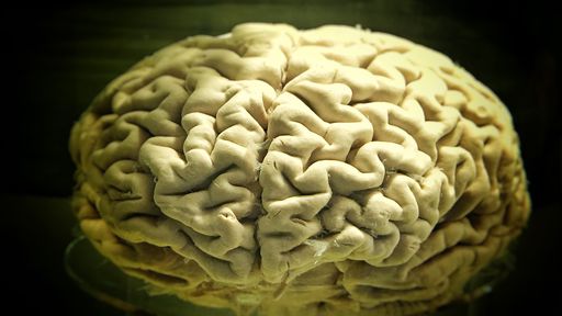Por que nossos cérebros têm tantas dobras?