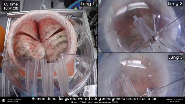 Pesquisadores norte-americanos conseguem recuperar série de pulmões para transplante (Foto: reprodução/ Columbia University)