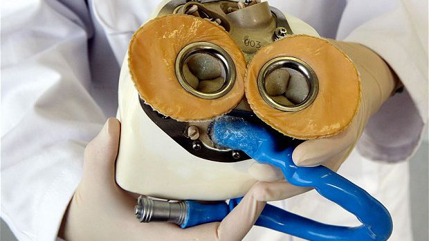 Primeiro coração artificial autônomo é implantado em paciente