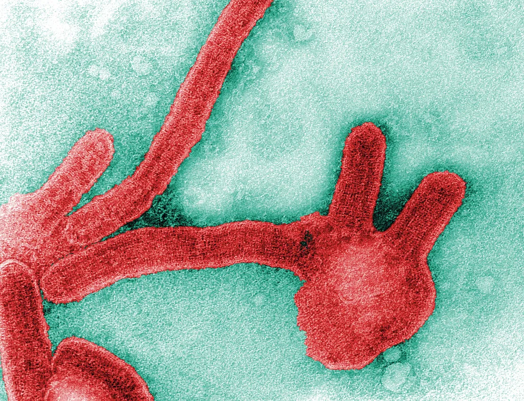 A OMS classifica como "ineficientes" as medidas de controle do vírus Marburg na Guiné Equatorial (Imagem: Frederick Murphy/CDC)