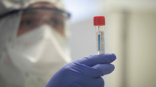 Ministério investe em mais de 20 milhões de exames do tipo RT-PCR (Foto: reprodução/ USA Today)