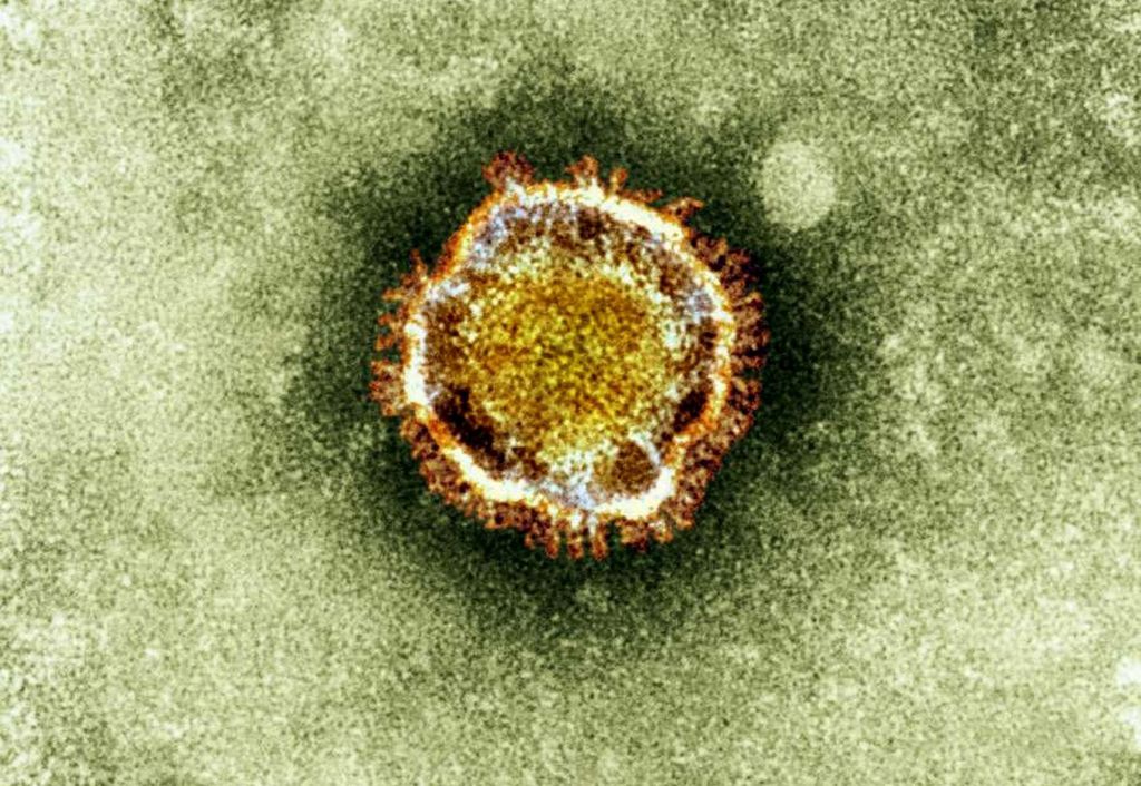 Coronavírus x H1N1: por que não dá para comparar as duas pandemias?