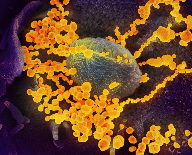 Todos falam, mas poucos viram: confira imagens reais do coronavírus em ação