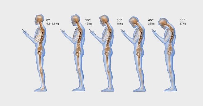 Diagrama mostra os efeitos no corpo da chamada síndrome do pescoço de texto (Imagem: TheNeckJoint.com)