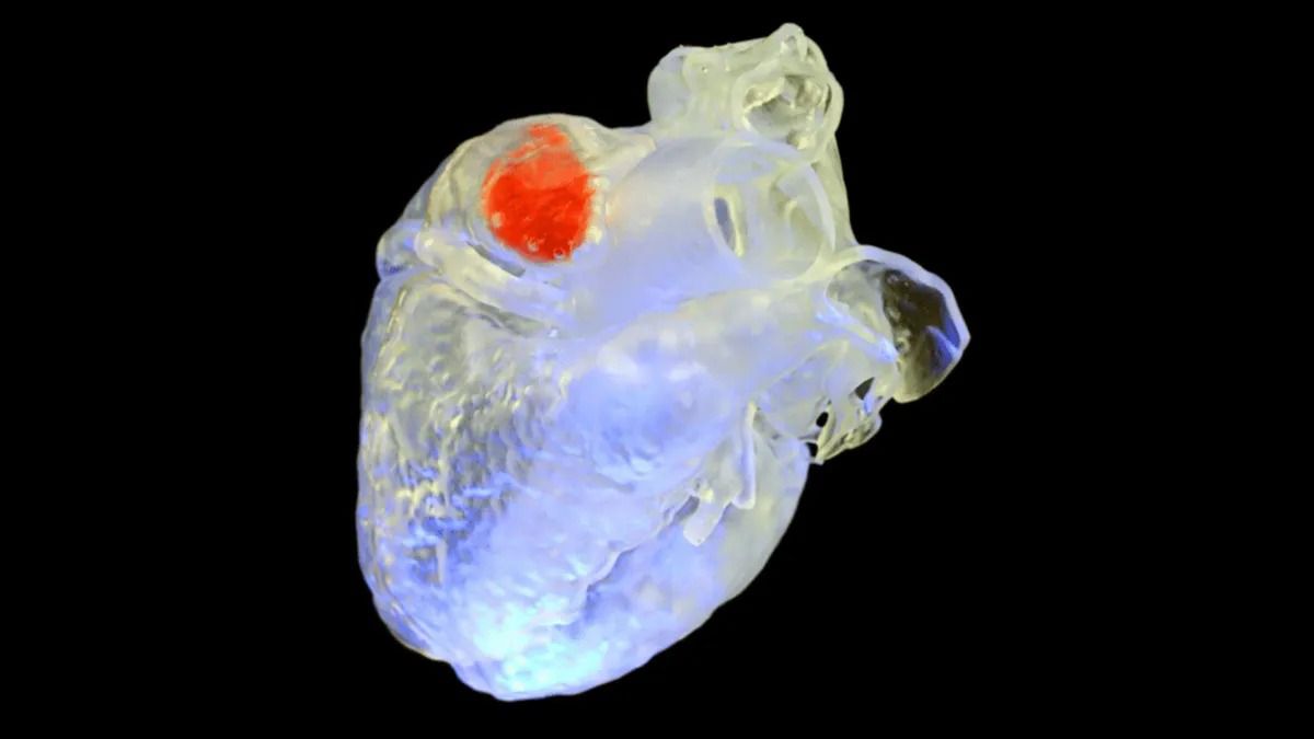 Wissenschaftler nutzen Ultraschall für den 3D-Druck im Inneren des menschlichen Körpers