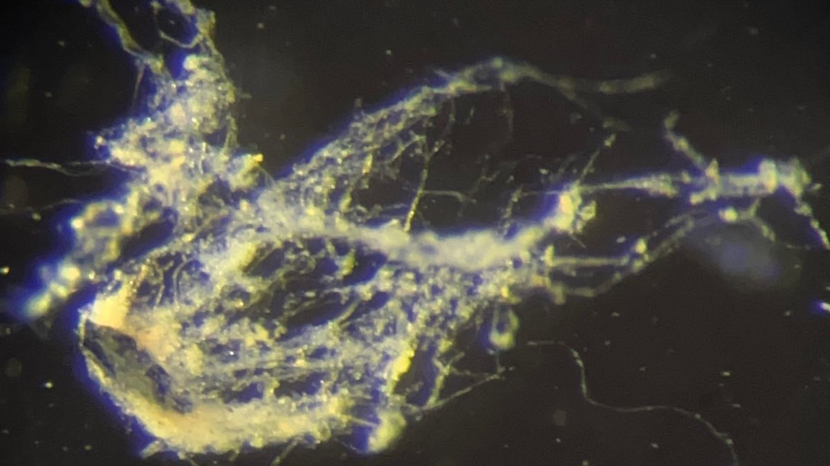Bioeletrônica | Descoberto novo tipo de bactéria que é condutora de eletricidade
