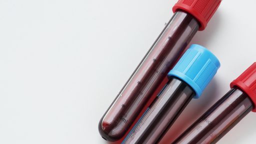 Novo exame de sangue mostra se tratamento contra câncer está dando certo