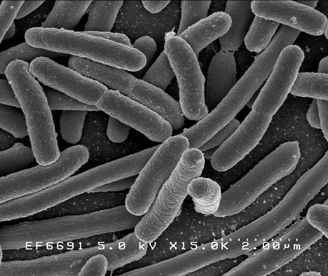 Escherichia coli, uma das muitas espécies de bactérias presentes no intestino humano (Imagem: Rocky Mountain Laboratories/Domínio Público)