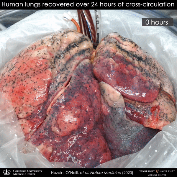 Pesquisadores resgatam pulmões danificados para transplante em 24h (Gif: reprodução/ Columbia University)