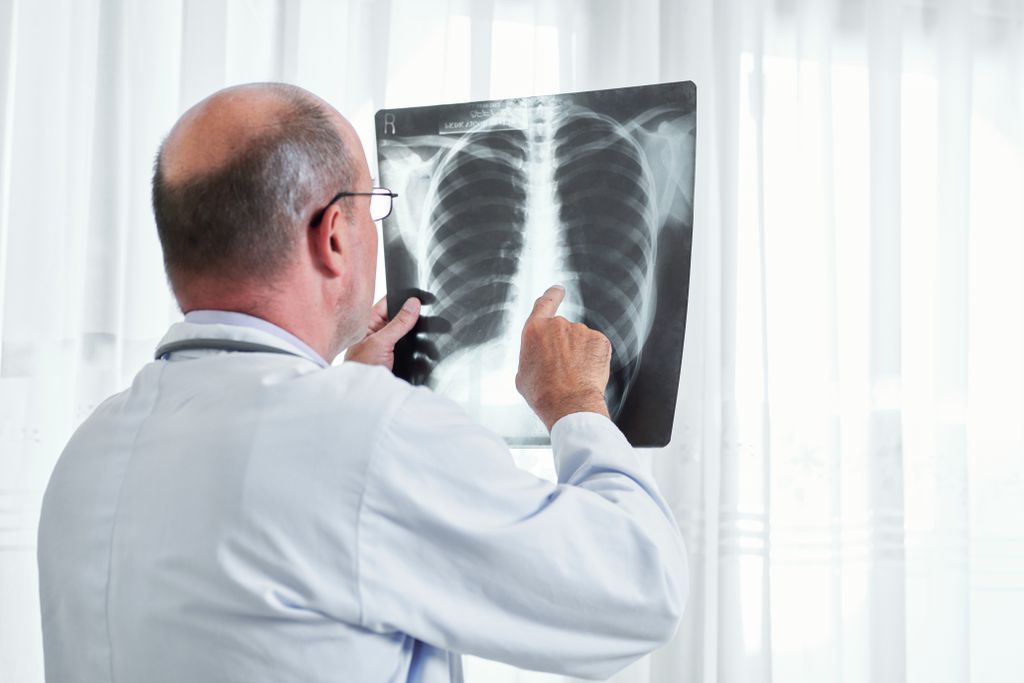 Radiografia de tórax ou mamografia é fonte de exposição muito baixa de radiação (Imagem: Reprodução/DragonImages/Envato Elements)