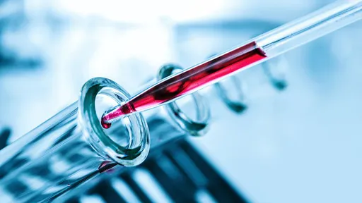 Cientistas criam exame de sangue capaz de prever risco de morte